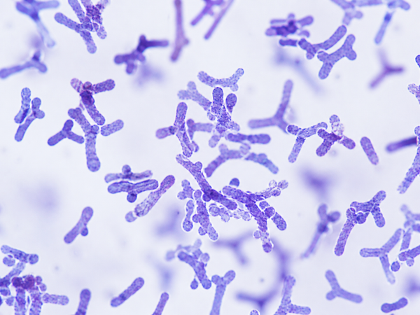 Bifidobacterium lactis